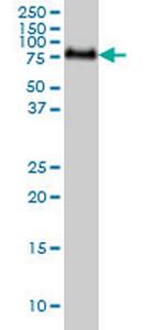 GALNT6 Antibody in Western Blot (WB)