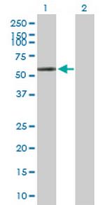 POLG2 Antibody in Western Blot (WB)