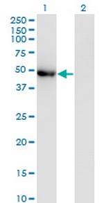 POLG2 Monoclonal Antibody (1A2)