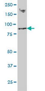 RNF139 Monoclonal Antibody (3D10)