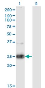 NXPH3 Monoclonal Antibody (4C8)