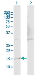 TP53TG1 Polyclonal Antibody, MaxPab™