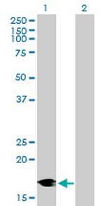 DCTN3 Antibody in Western Blot (WB)