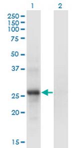SNF8 Monoclonal Antibody (6B11)
