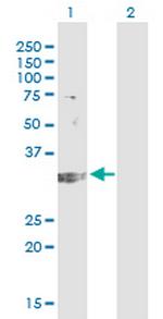 TREX1 Monoclonal Antibody (2F10)