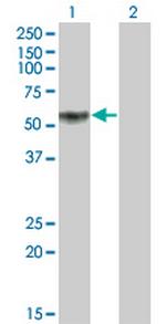 KLF12 Monoclonal Antibody (3E4)