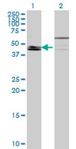 KLF8 Monoclonal Antibody (2E10)