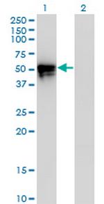 KLF8 Monoclonal Antibody (3F10)