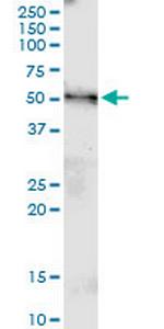 MGAT4B Monoclonal Antibody (1F4)
