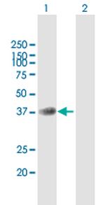 B4GALT7 Polyclonal Antibody, MaxPab™