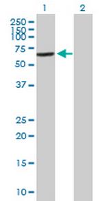 VPS45 Polyclonal Antibody, MaxPab™