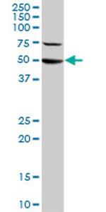 STK38 Antibody in Western Blot (WB)