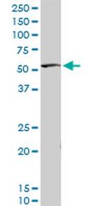 STK38 Antibody in Western Blot (WB)