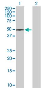 STK38 Polyclonal Antibody, MaxPab™
