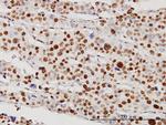 STK38 Antibody in Immunohistochemistry (Paraffin) (IHC (P))