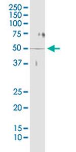 STK38 Antibody in Immunoprecipitation (IP)