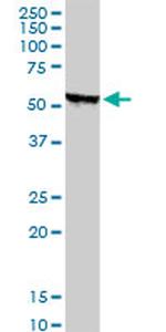 STK38 Antibody in Western Blot (WB)