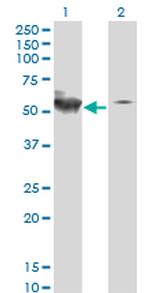 STK38 Antibody in Western Blot (WB)