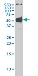 STK38 Antibody in Western Blot (WB)