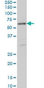 STK38 Monoclonal Antibody (2F6)