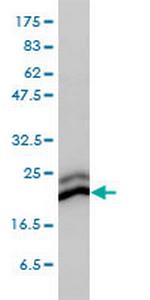 CBX3 Monoclonal Antibody (1G12-1D9)