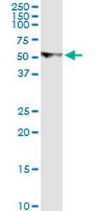 U2AF2 Monoclonal Antibody (5G8)