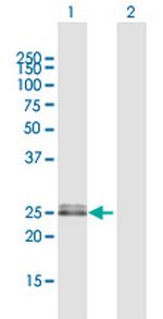 OIP5 Polyclonal Antibody, MaxPab™
