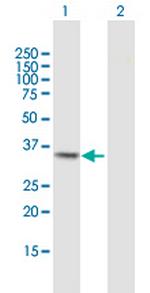 MGLL Polyclonal Antibody, MaxPab™