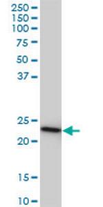 RRAS2 Monoclonal Antibody (2D3-4B8)