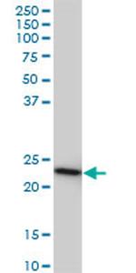 RRAS2 Antibody in Western Blot (WB)
