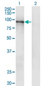 RASA3 Antibody in Western Blot (WB)