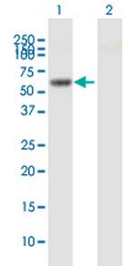RHOBTB3 Polyclonal Antibody, MaxPab™