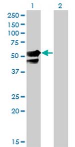 AAK1 Monoclonal Antibody (4B10)