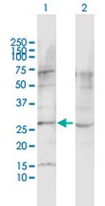 LPHN1 Polyclonal Antibody, MaxPab™