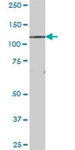 FNDC3A Antibody in Western Blot (WB)