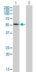 ABLIM3 Polyclonal Antibody, MaxPab™