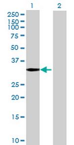 ZNF365 Antibody in Western Blot (WB)