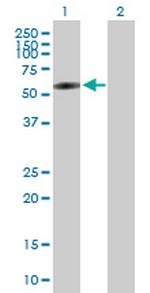 BTBD3 Polyclonal Antibody, MaxPab™