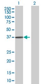 MAPRE3 Antibody in Western Blot (WB)