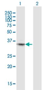 ATF6 Antibody in Western Blot (WB)