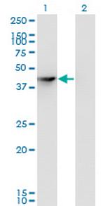 SEPHS1 Antibody in Western Blot (WB)