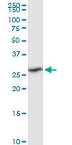 RPIA Polyclonal Antibody, MaxPab™