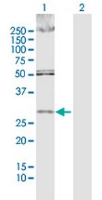 DKK1 Polyclonal Antibody, MaxPab™