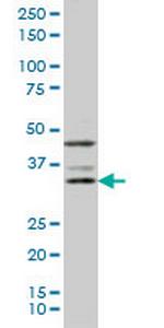 DKK1 Monoclonal Antibody (4D4)
