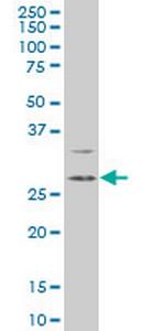 DKK1 Monoclonal Antibody (3D9)