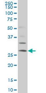 DKK1 Monoclonal Antibody (3G3)