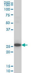 DKK1 Monoclonal Antibody (1A3)