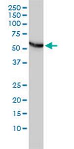 CCT5 Monoclonal Antibody (4E5-4B1)