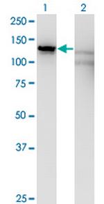 SLC4A1AP Antibody in Western Blot (WB)