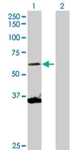 SCMH1 Polyclonal Antibody, MaxPab™